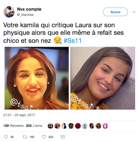 kamila ss11 ses proches reagissent aux preuves de son recours au bistouri gossip