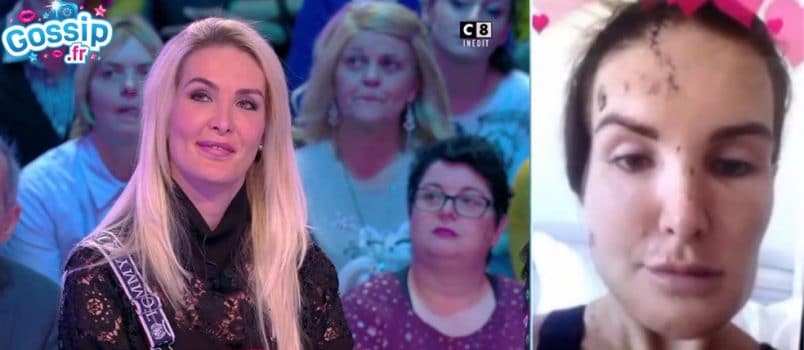 Marie Garet aurait "préféré être morte belle que vivante et moche", elle s'explique sur ses propos polémiques!